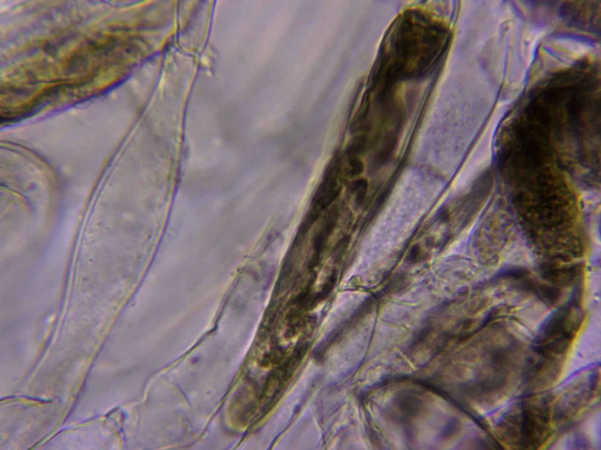 12 - Pileipellis 1